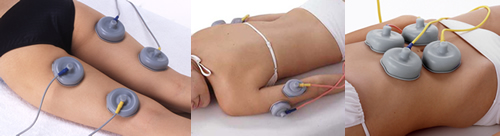 腹部、背中、大腿、二の腕、胸など様々な場所が施術可能です。