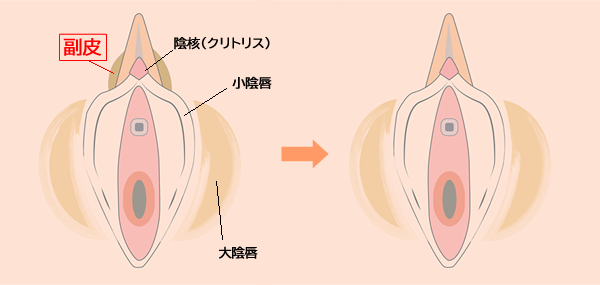 副皮