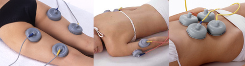 腹部、背中、大腿、二の腕、胸など様々な場所が施術可能です。
