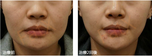 美容外科 美容皮膚科 形成外科 共立美容外科仙台院