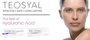 TEOSYAL The Best of Hyaluronic Acid